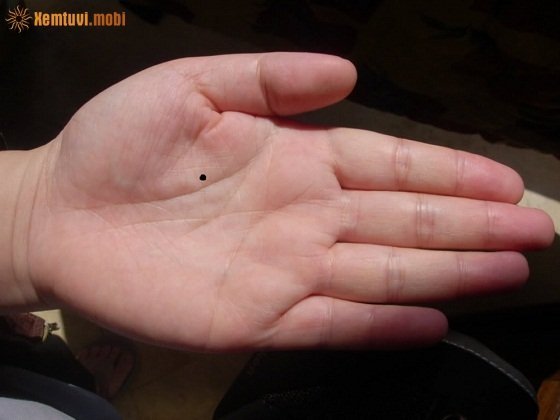 Nốt ruồi trong lòng bàn tay là nốt ruồi quý tướng