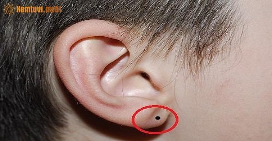 Nốt ruồi ở dái là người có phúc khí, sống trường thọ