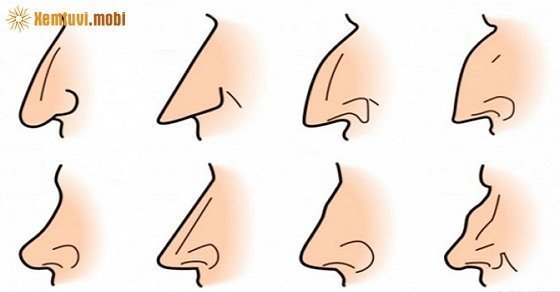 Xem tướng mũi tẹt: Mũi tẹt tốt hay xấu? Cách khắc phục mũi tẹt