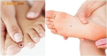 Xem nốt ruồi ở chân - Bói nốt ruồi dưới lòng bàn chân, ngón chân chuẩn xác Xem nốt ruồi ở chân - Bói nốt ruồi dưới lòng bàn chân, ngón chân chuẩn xác