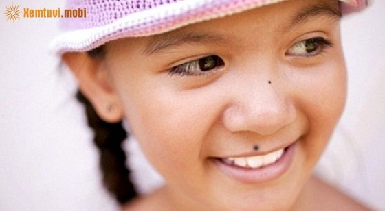 Nốt ruồi ở môi trên bên trái mang vận số giàu sang, phú quý