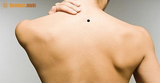 Xem tướng nốt ruồi sau gáy đàn ông, phụ nữ