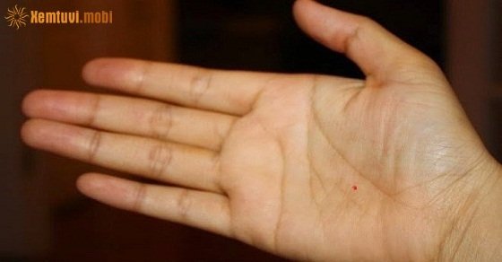 Nốt ruồi son trong lòng bàn tay là viên ngọc được nắm trong tay Nốt ruồi son trong lòng bàn tay là viên ngọc được nắm trong tay