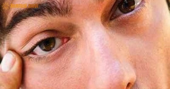 Mắt phải giật (Nháy mắt phải) ở Nữ & Nam theo 12 khung giờ