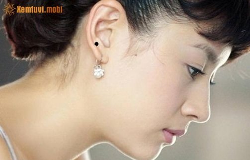 Nốt ruồi trên tai phải được coi là vận bang phu