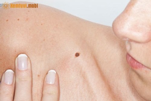 Xem bói nốt ruồi ở xương quai xanh bên trái, bên phải phụ nữ và đàn ông