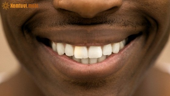 Đàn ông môi thâm là người như thế nào