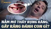 Nằm mơ thấy rụng răng, mơ gãy răng đánh con gì? Ý nghĩa chiêm bao thấy rụng răng